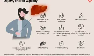 Ilustracja przedstawia objawy chorób wątroby, w tym zmęczenie, ból brzucha, swędzenie skóry, zmiany apetytu, żółtaczkę, nudności i ból stawów. Wątroba jest kluczowa dla zdrowia, a jej problemy mogą być związane z wirusem HCV.