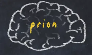 Szkic mózgu na tablicy, w środku żółty napis "priony".