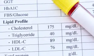 Wynik lipidogramu: cholesterol 175, triglicerydy 40, HDL-C 89, LDL-C 76. Wynik triglicerydów wskazuje na wysokie trójglicerydy.