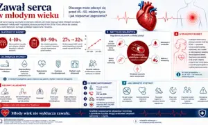 Infografika o objawach zawału serca u młodych osób. Przedstawia czynniki ryzyka, alarmujące symptomy, przyczyny i sposoby zapobiegania.
