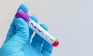 Rękawiczka w niebieskiej rękawiczce trzyma probówkę z oznaczeniem "Toxoplasma" i zaznaczonym wynikiem dodatnim.