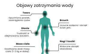 Objawy zatrzymania wody: opuchlizna twarzy, dłoni, brzucha, nóg i kostek, gwałtowne skoki masy ciała. Dowiedz się, jak pozbyć się wody z organizmu.