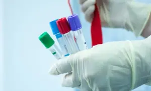 Czy badania hormonalne są na NFZ? Sprawdź, co musisz wiedzieć