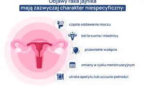 Objawy raka jajnika: częste oddawanie moczu, ból brzucha, wzdęcia, zmiany cyklu, utrata apetytu. Wczesne rozpoznanie jest kluczowe.