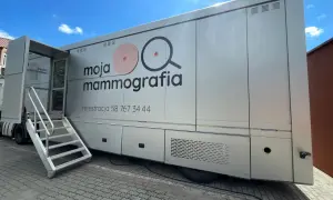 Mammografia na NFZ od jakiego wieku? Sprawdź, czy jesteś uprawniona