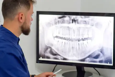 Czy pantomogram jest na NFZ? Sprawdź, co musisz wiedzieć, aby skorzystać