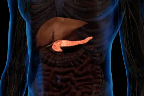 Trzustka, organ kluczowy dla trawienia, może być dotknięta przez raka trzustki. Widok anatomiczny uwypukla jej położenie.