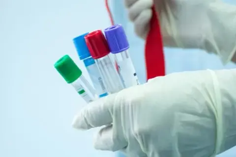 Czy badania hormonalne są na NFZ? Sprawdź, co musisz wiedzieć