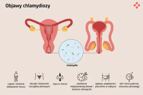 Objawy chlamydiozy: ból przy oddawaniu moczu, obrzęk narządów płciowych, ropna wydzielina, plamienia, pieczenie w odbycie, ból i krew podczas stosunku.