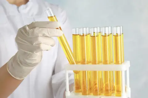 Rękawiczka laboratoryjna trzyma probówkę z żółtym płynem, obok stoją kolejne probówki. Analiza na obecność glukozy w moczu.