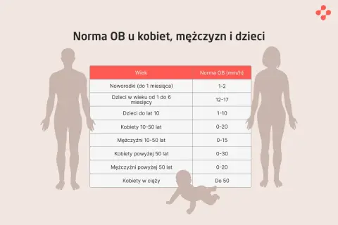 Tabela przedstawia normy odczynu Biernackiego (OB) dla różnych grup wiekowych i płci, od noworodków po kobiety w ciąży.