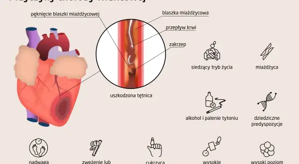 Ilustracja przedstawia serce i czynniki ryzyka choroby wieńcowej: miażdżycę, nadwagę, cukrzycę, wysokie ciśnienie, alkohol, palenie, siedzący tryb życia i predyspozycje genetyczne.