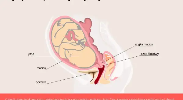Ilustracja przedstawia przekrój przez ciążową macicę z płodem. Widoczny jest czop śluzowy zamykający szyjkę macicy.