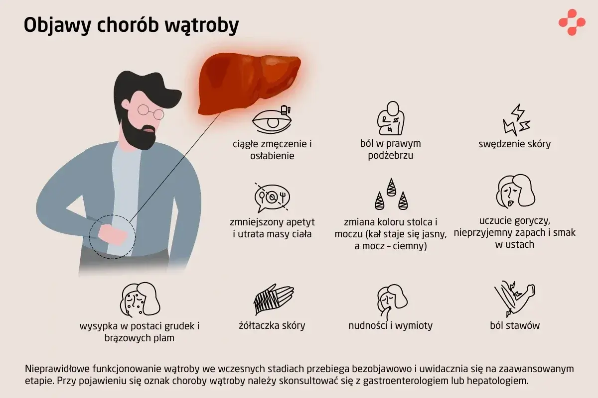 Ilustracja przedstawia objawy chorób wątroby, w tym zmęczenie, ból brzucha, swędzenie skóry, zmiany apetytu, żółtaczkę, nudności i ból stawów. Wątroba jest kluczowa dla zdrowia, a jej problemy mogą być związane z wirusem HCV.