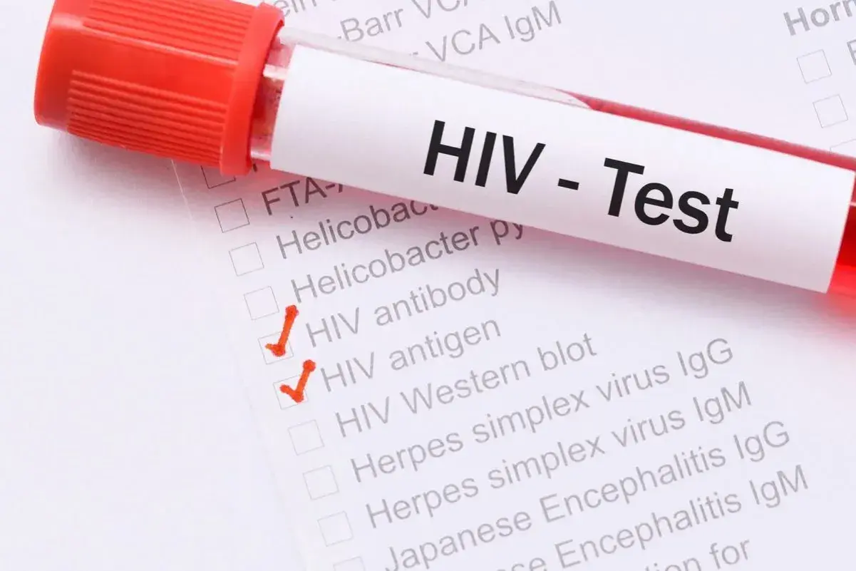 Probówka z krwią do testu HIV. Zaznaczone opcje: przeciwciała HIV i antygen HIV.