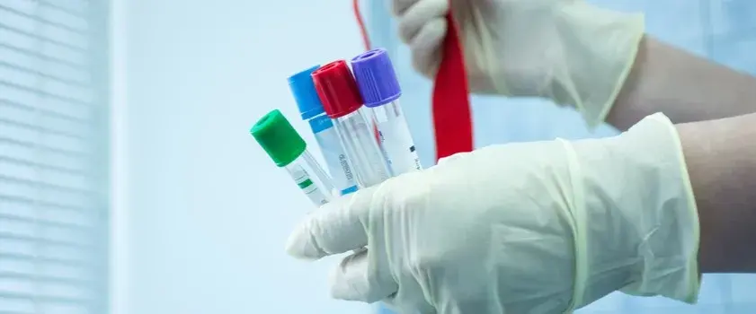 Czy badania hormonalne są na NFZ? Sprawdź, co musisz wiedzieć