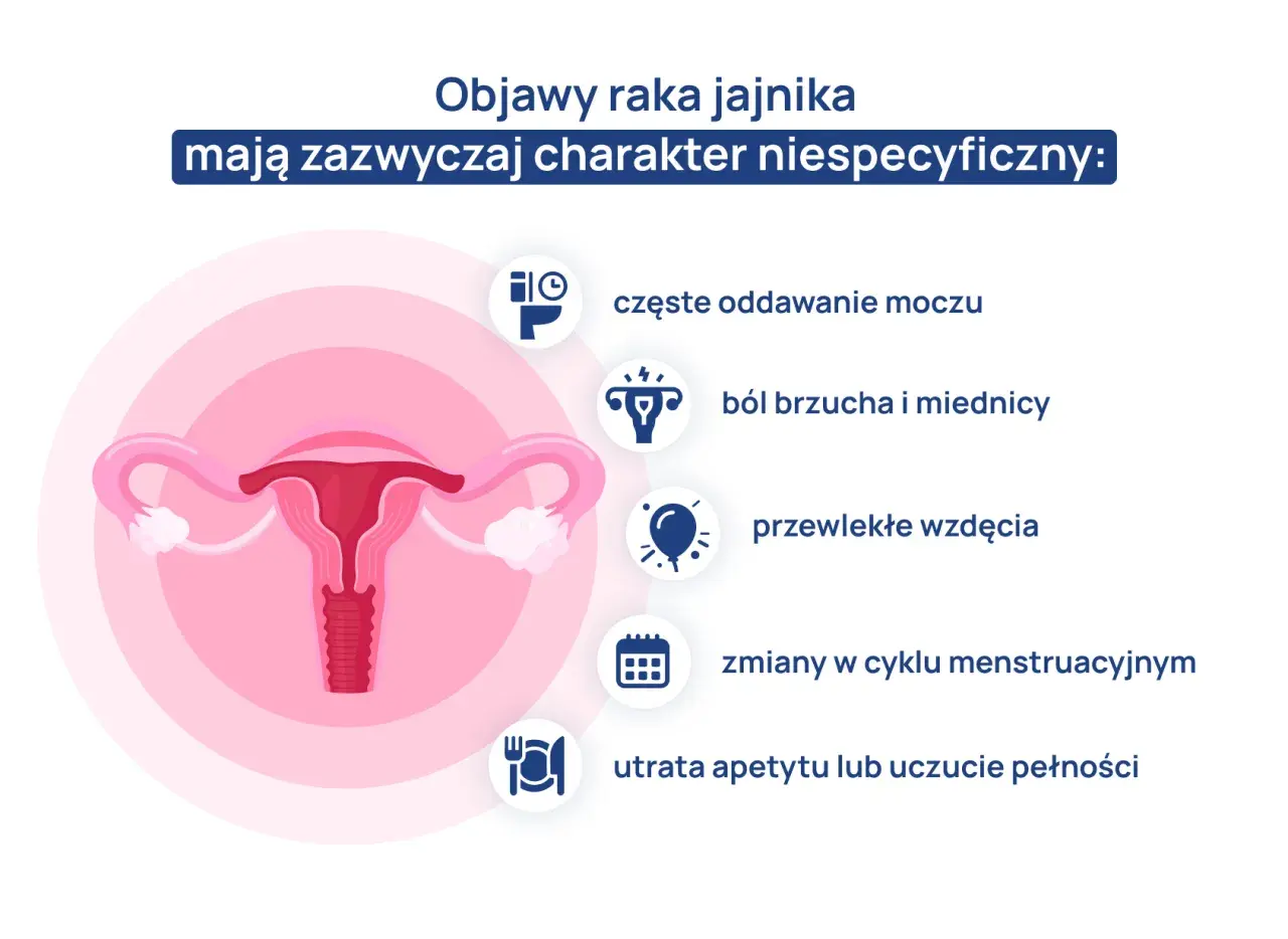 Objawy raka jajnika: częste oddawanie moczu, ból brzucha, wzdęcia, zmiany cyklu, utrata apetytu. Wczesne rozpoznanie jest kluczowe.