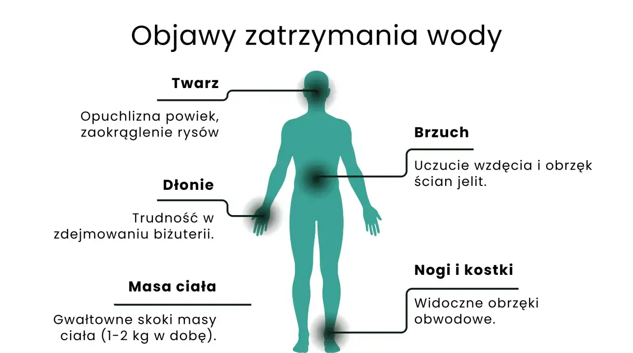 Objawy zatrzymania wody: opuchlizna twarzy, dłoni, brzucha, nóg i kostek, gwałtowne skoki masy ciała. Dowiedz się, jak pozbyć się wody z organizmu.