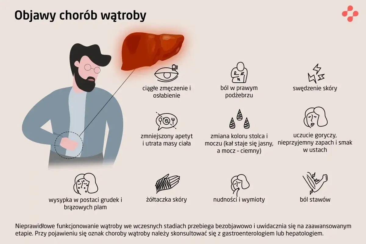 Ilustracja przedstawia objawy chorób wątroby, w tym zmęczenie, ból brzucha, swędzenie skóry, nudności, żółtaczkę. Wczesne stadia mogą być bezobjawowe, jak w przypadku hcv.