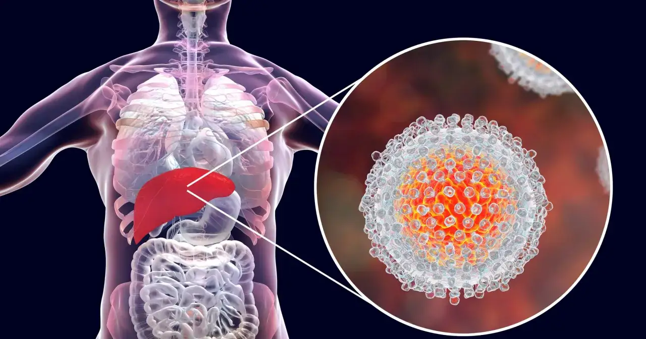 Wirus hcv atakuje wątrobę, która jest podświetlona na czerwono w ludzkim ciele. Powiększony obraz pokazuje strukturę wirusa.