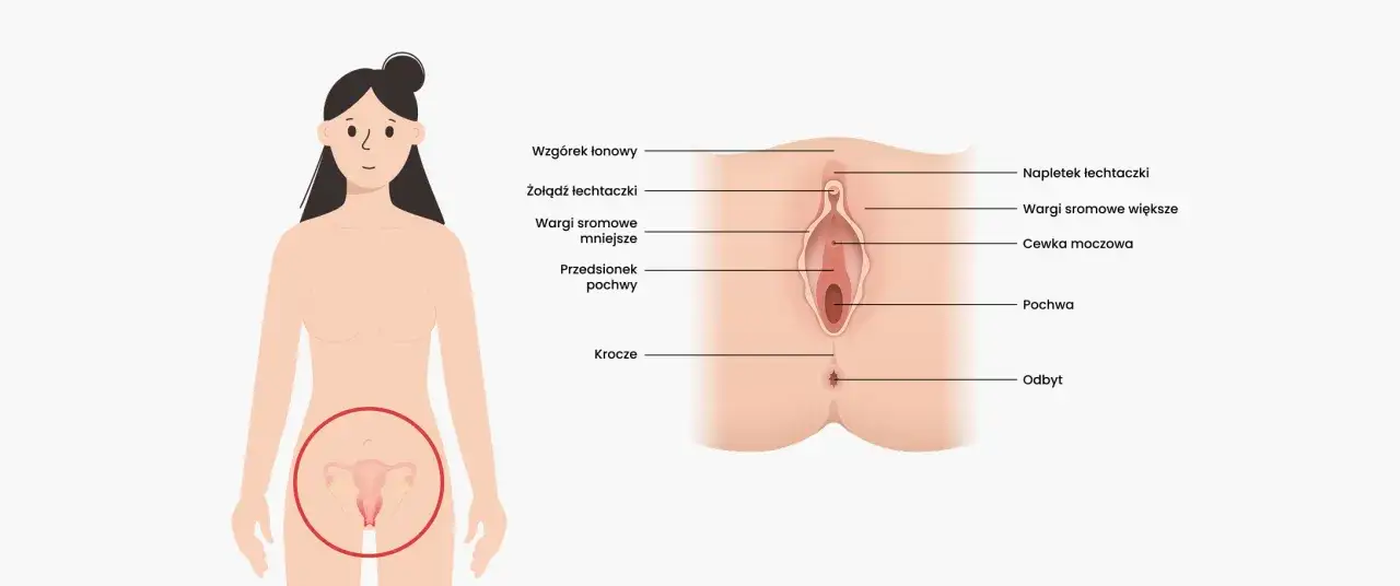 Ilustracja anatomiczna przedstawiająca narządy płciowe kobiety, z zaznaczonymi elementami takimi jak łechtaczka, wargi sromowe i pochwa. Informuje o budowie, która może być dotknięta rakiem sromu.