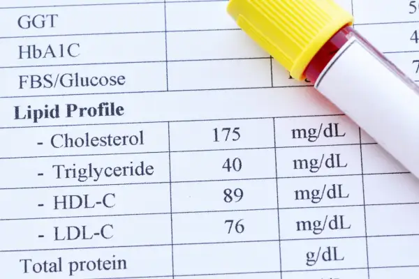 Wynik lipidogramu: cholesterol 175, triglicerydy 40, HDL-C 89, LDL-C 76. Wynik triglicerydów wskazuje na wysokie trójglicerydy.