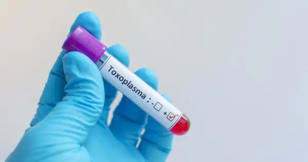 Rękawiczka w niebieskiej rękawiczce trzyma probówkę z oznaczeniem "Toxoplasma" i zaznaczonym wynikiem dodatnim.