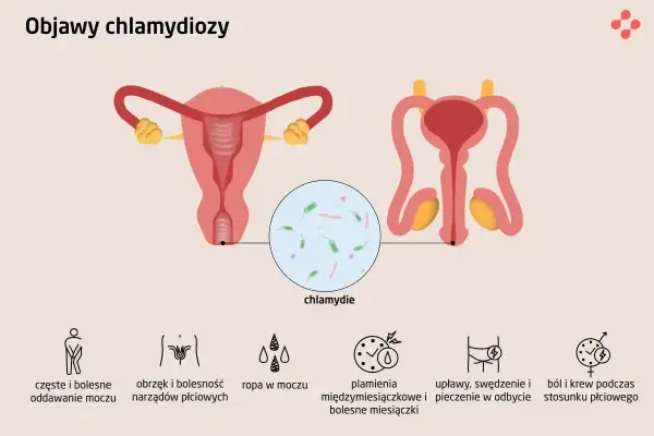 Objawy chlamydiozy: ból przy oddawaniu moczu, obrzęk narządów płciowych, ropna wydzielina, plamienia, pieczenie w odbycie, ból i krew podczas stosunku.